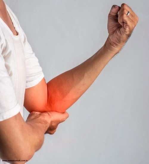Golfçü Dirseği (Medial Epikondilit) Nedir?