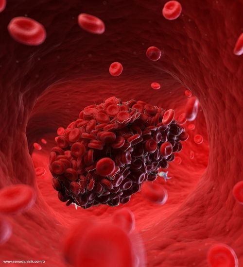 Hiperlipidemi Tedavisinde Fizyoterapinin Rolü ve Önemi