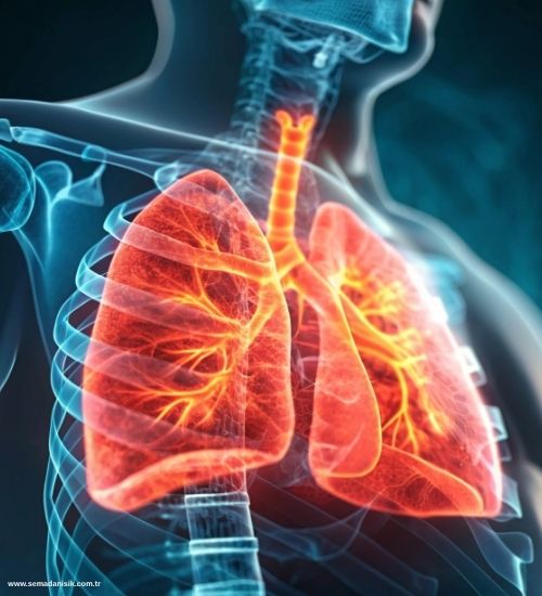 KOAH'ta Fizyoterapi ve Rehabilitasyon Samsun Sema Danışık