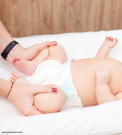 Kalça Çıkığı Belirtileri Nelerdir?