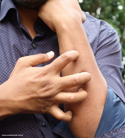 Kemik iltihabı (Osteomyelit) Samsun Fizyoterapi