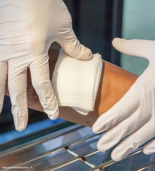 Kronik Yara Nedir ve Neden Oluşur?