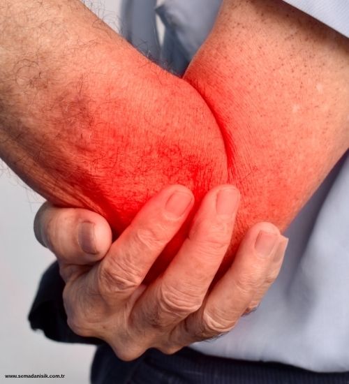 Tenisçi Dirseği Tedavisi ve Fizyoterapinin Rolü