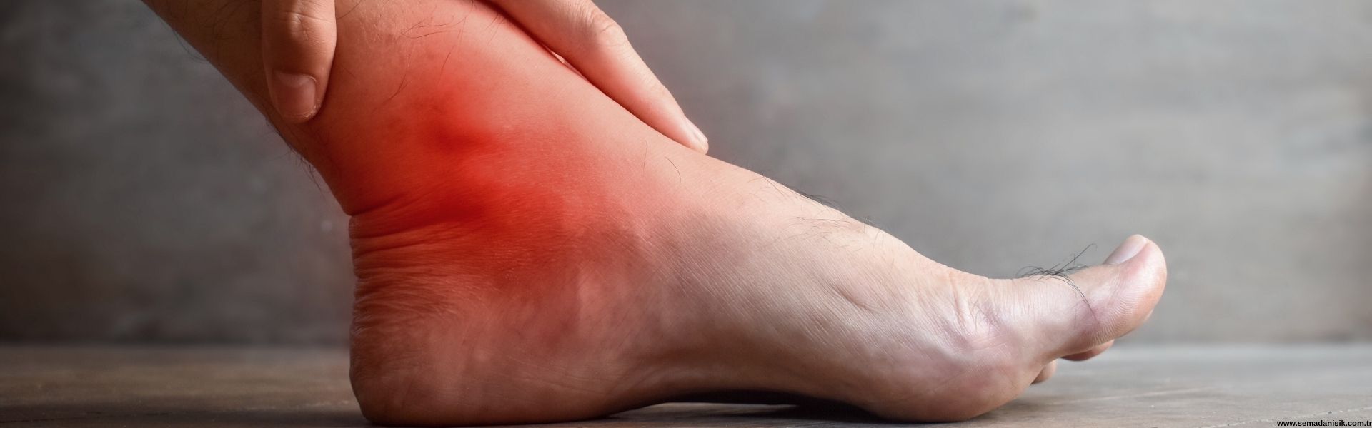 Burkulma ve Ezilmelerde Fizyoterapi Samsun