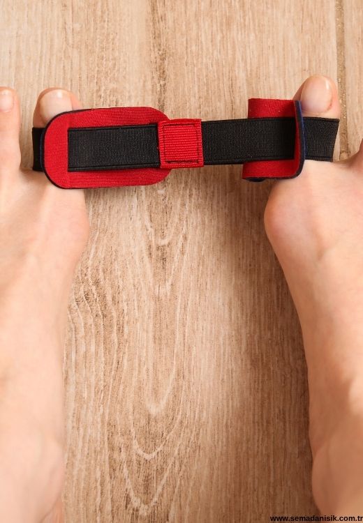 Hallux Valgus Başparmak Çıkıntısı Tedavisi Samsun