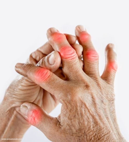 Kemik İltihabı (Osteomiyelit) Nasıl Tedavi Edilir?