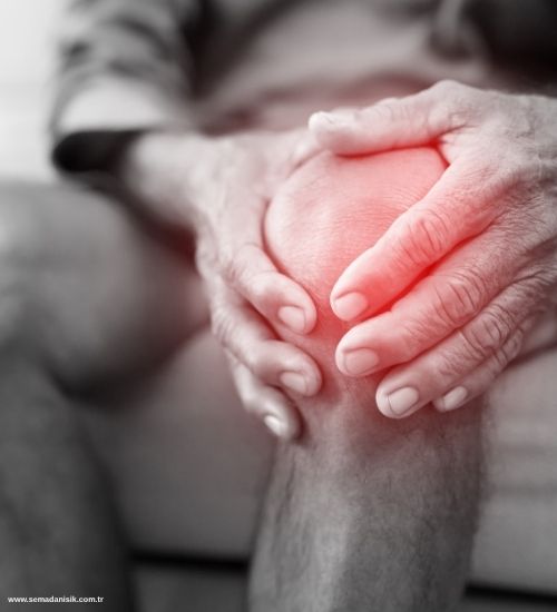 Kireçlenme (Osteoartrit) Nedir?