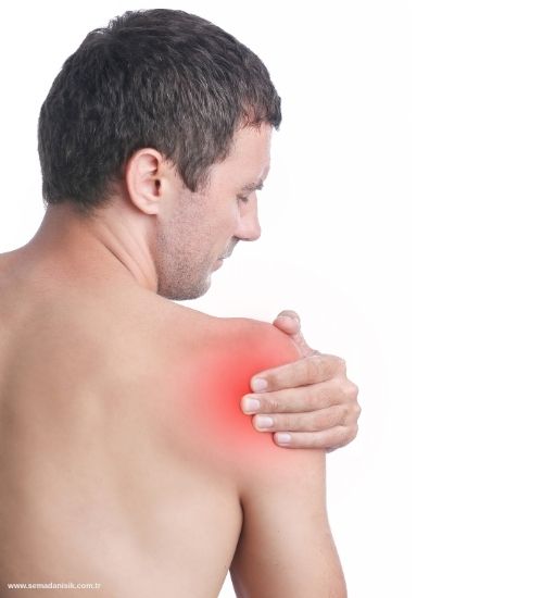 Omuz Kas Yırtığı (Rotator Manşet Yırtığı) Nedir?